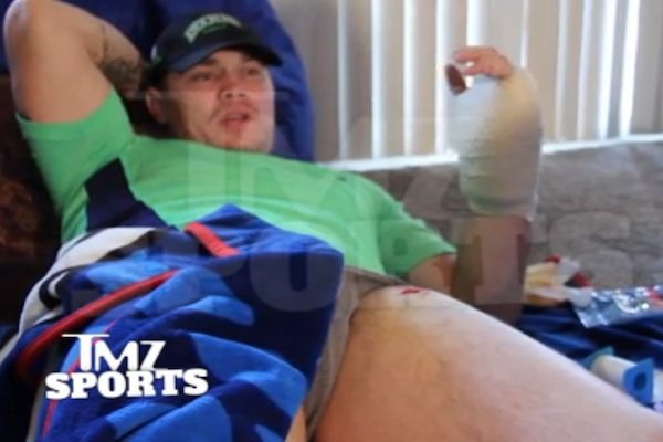 GRAPHIC: MMA fighter shows off self-inflicted gunshot wounds