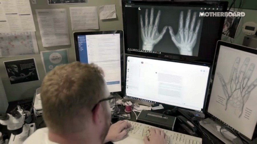 Biohacker Implants 'Smart Gun' Key That Can Never be Dropped