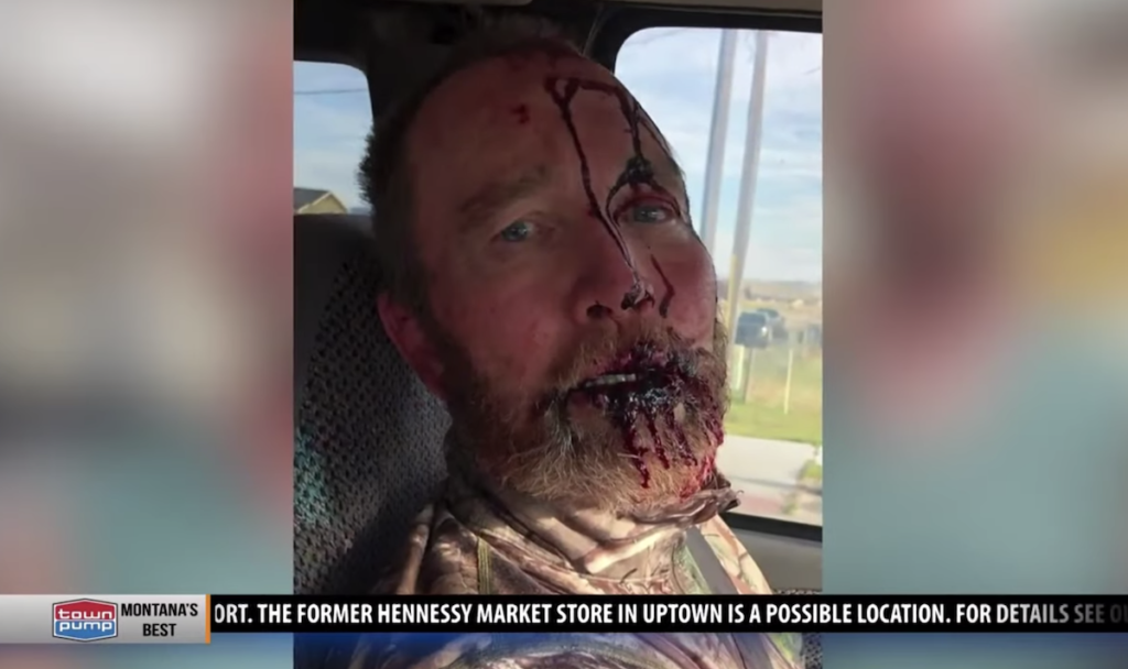 Four Hunters in Montana Mauled by Grizzly Bear in Three Attacks