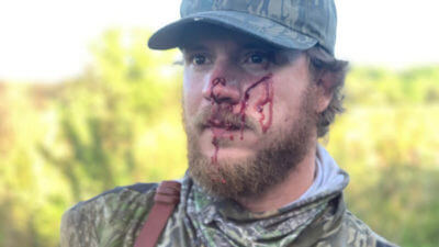 Man Attacked by Panther while Turkey Hunting in Florida