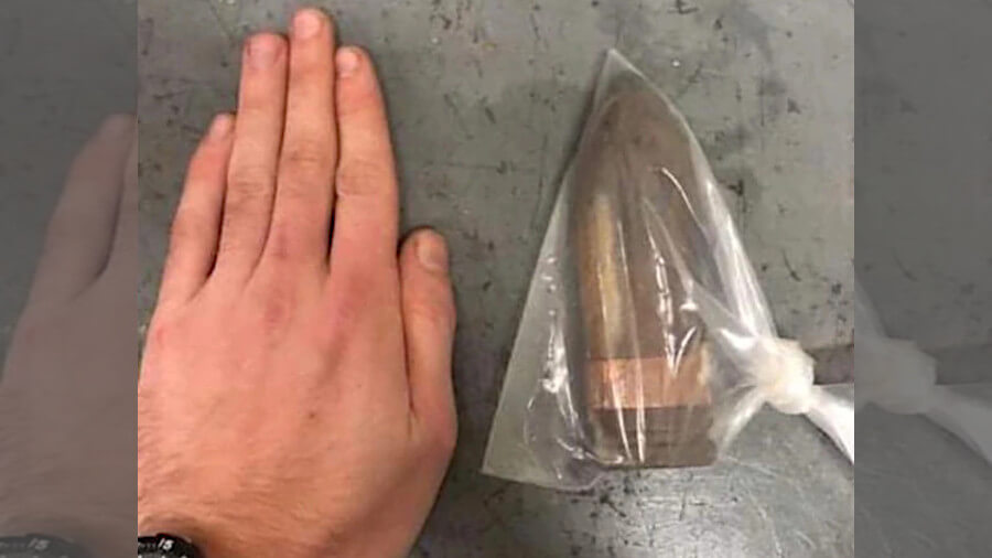 Bomb Squad Called to U.K. Hospital for Patient with Shell Stuck in Behind