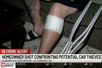 A close up of the wounded leg with a bandage on it.